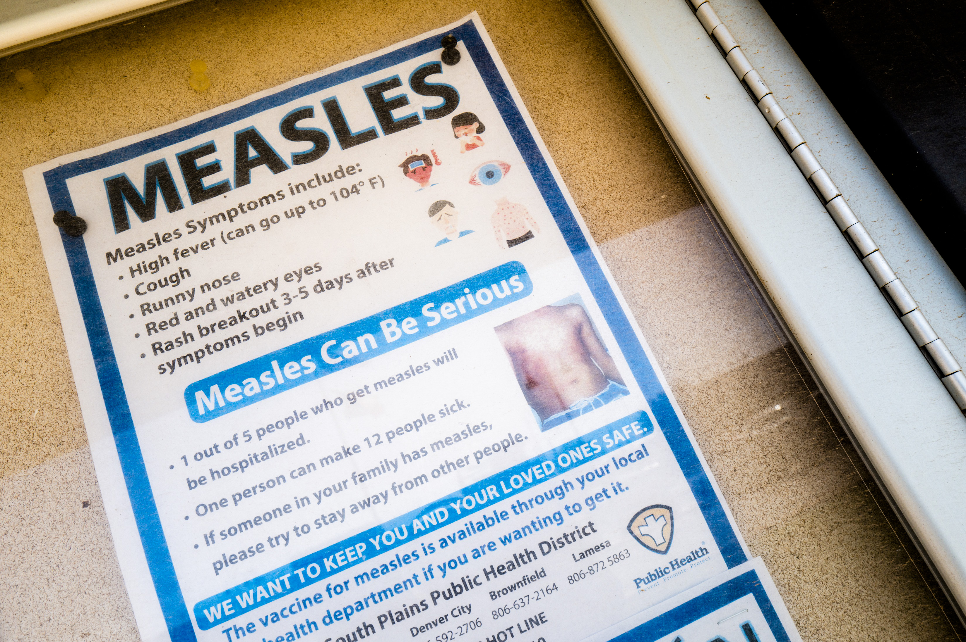 Second Child Dies As Measles Outbreak Continues To Spread In Texas