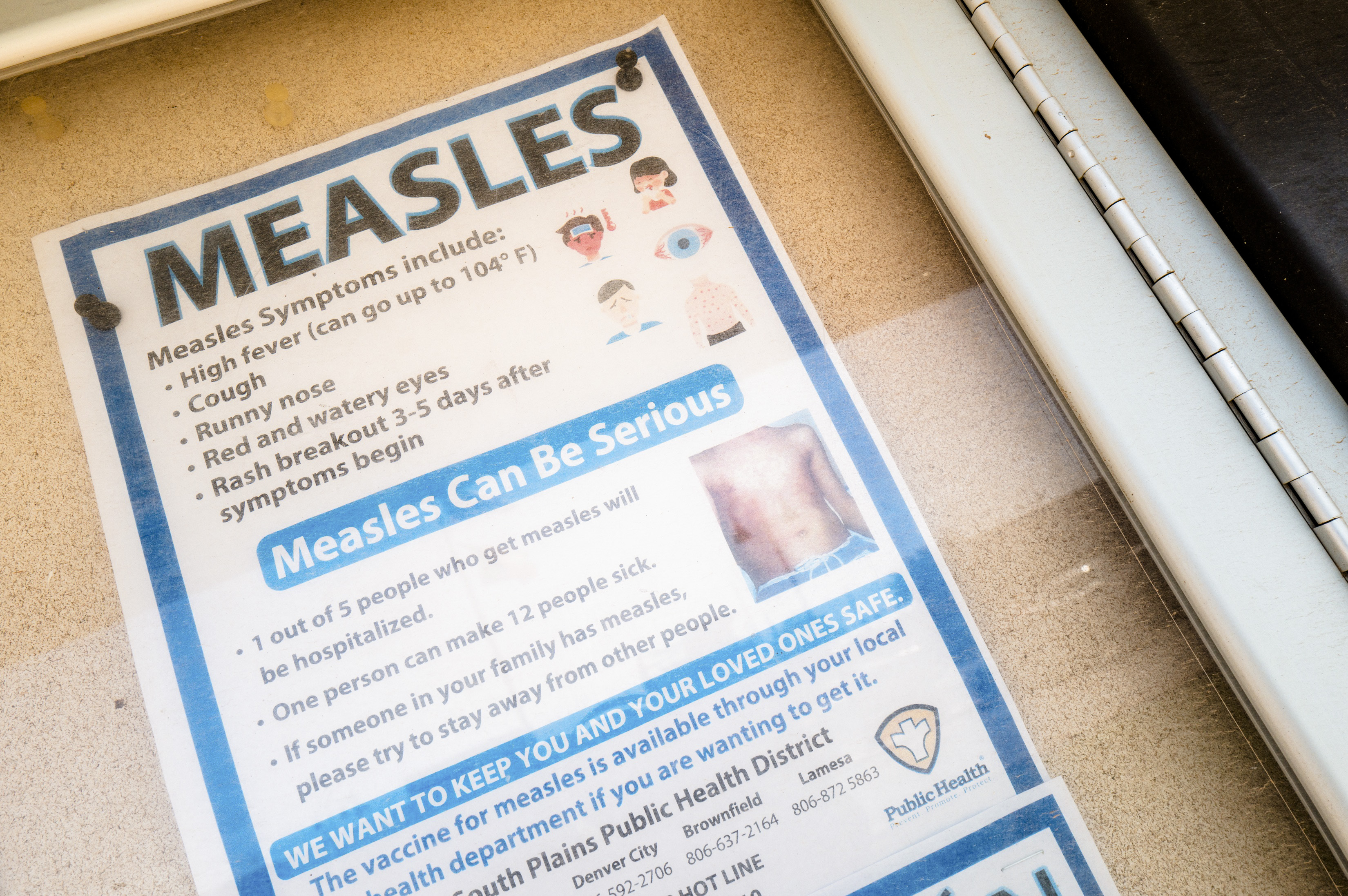 Second Child Dies As Measles Outbreak Continues To Spread In Texas