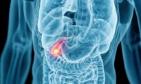 Is Gallbladder Removal Always Necessary? What Patients Should Know