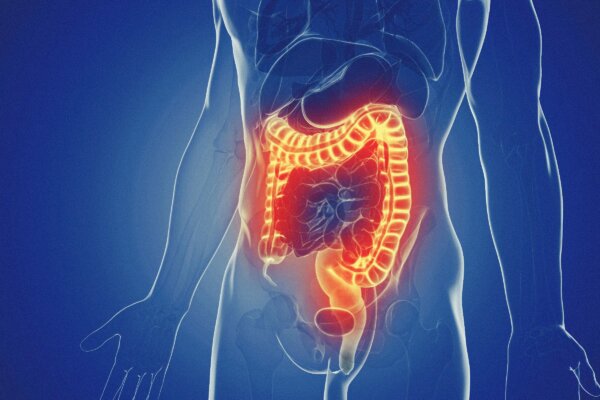 Fear Is Linked to Worse Pain in IBD