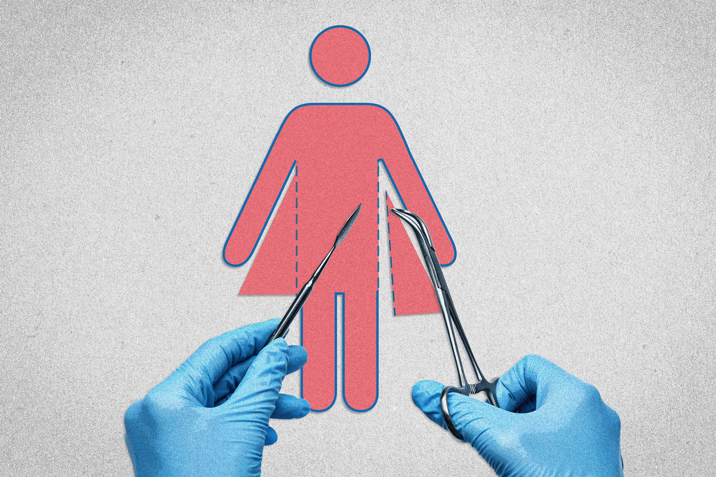 Landmark $2 Million Trans Surgery Verdict Marks a Turning Point