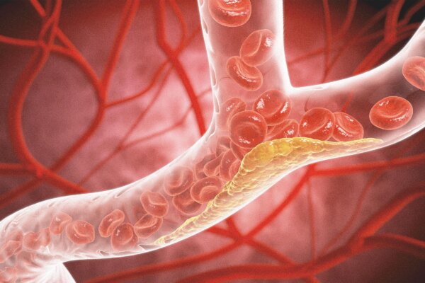 Beyond Cholesterol: The Hidden Changes That Shape Heart Health