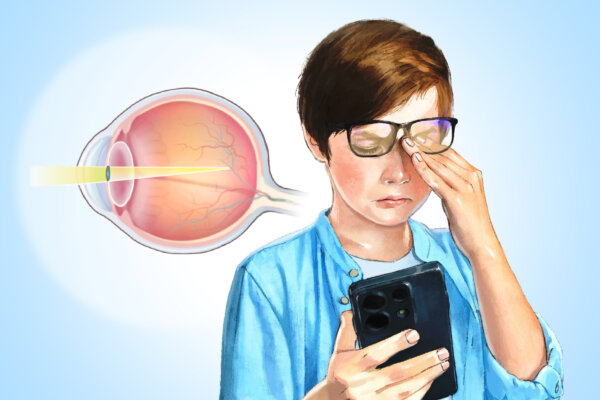 Myopia: 2 in 5 People Are Affected–Here's How to Slow Progression