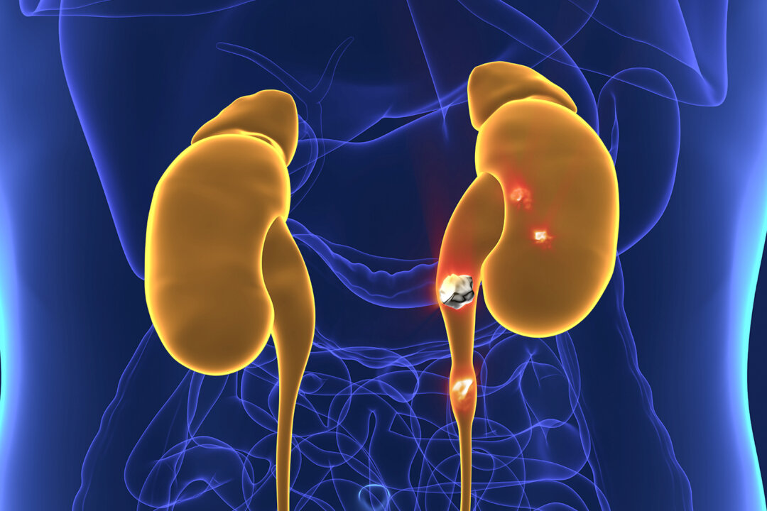 (decade3d - anatomy online/Shutterstock)