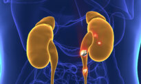 Kidney Stones May Actually Be Bacterial Colonies, Study Finds