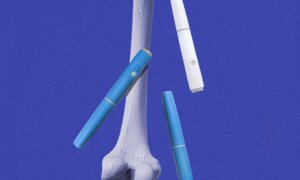 Weight Loss Drugs Linked to Bone Health Risks, 5-Year Data Finds