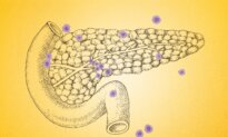 7 Overlooked Warning Signs of Pancreatic Cancer