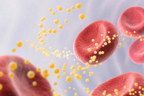  Is High Cholesterol Really Bad?