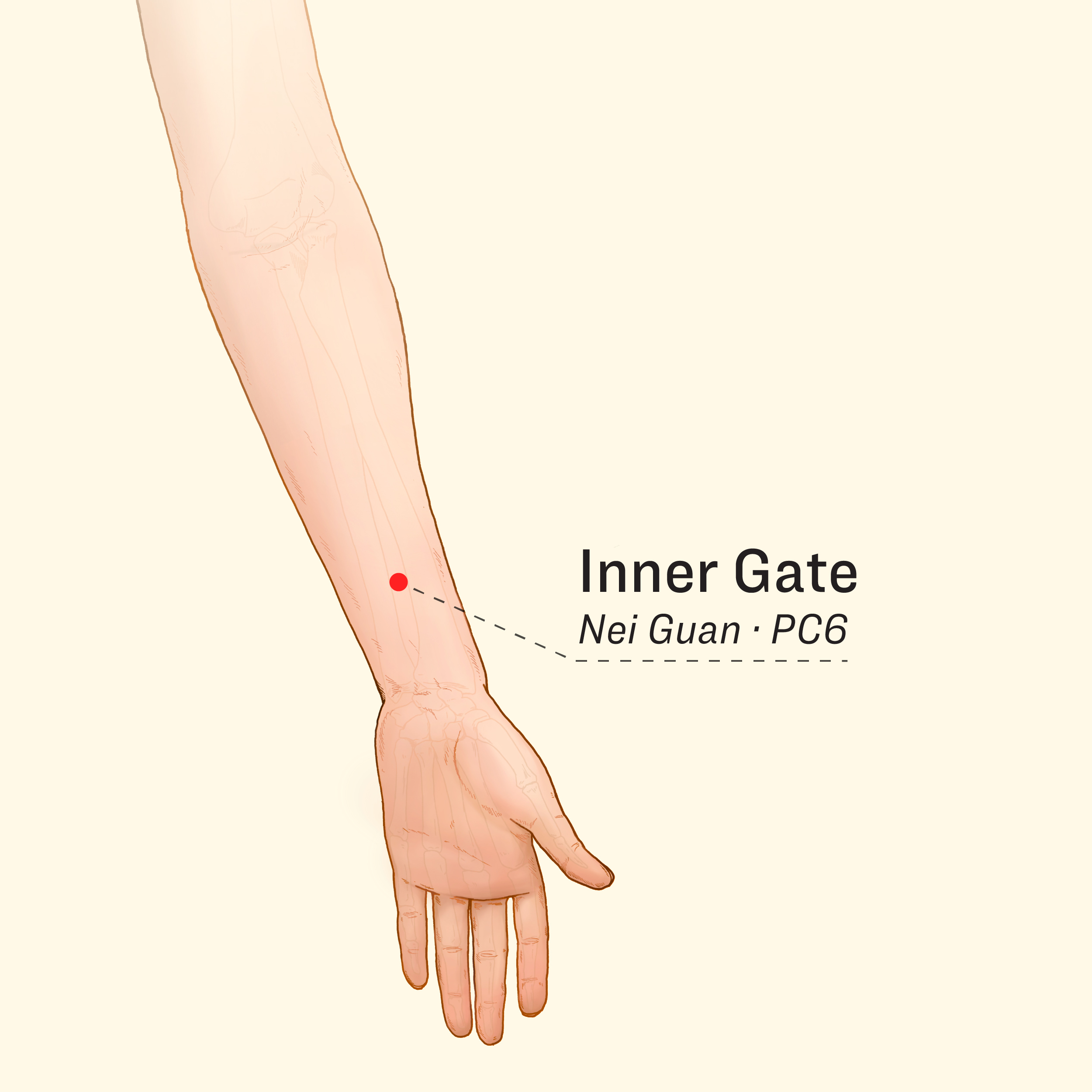 Location of the Inner Gate acupoint. (The Epoch Times)