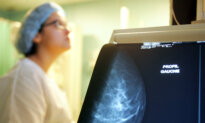 Doctor Group Updates Guidance on Breast Cancer Screening