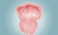 Enlarged Prostate: Most Common Prostate Condition in Aged Men–Here Are the Causes
