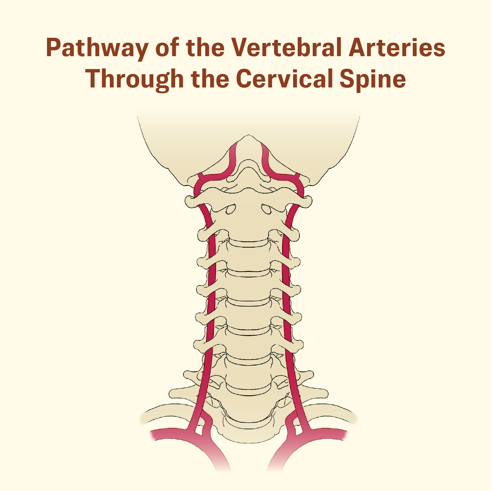 Pathway of the vertebral arteries through the cervical spine. (The Epoch Times)