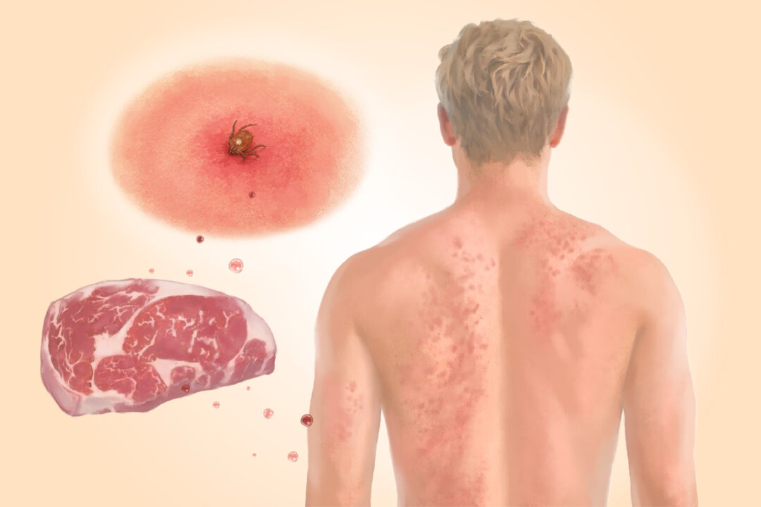 (Illustration by The Epoch Times, Shutterstock)