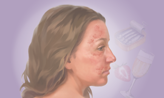 Histamine Intolerance: An Underrecognized Condition That Can Affect Multiple Organs–Here Are the Causes
