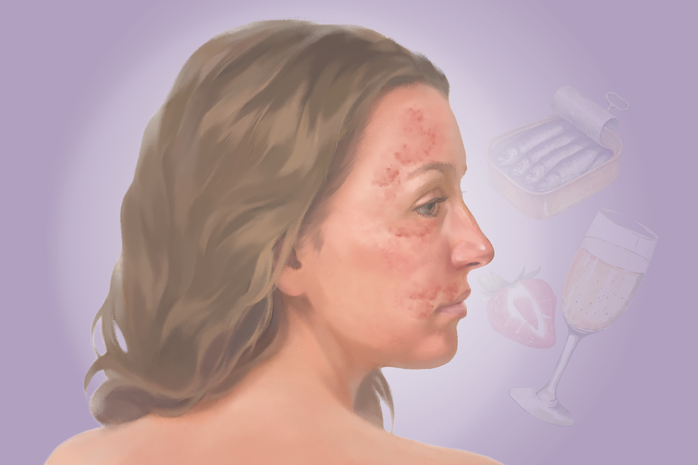 Histamine Intolerance: An Underrecognized Condition That Can Affect Multiple Organs–Here Are the Causes