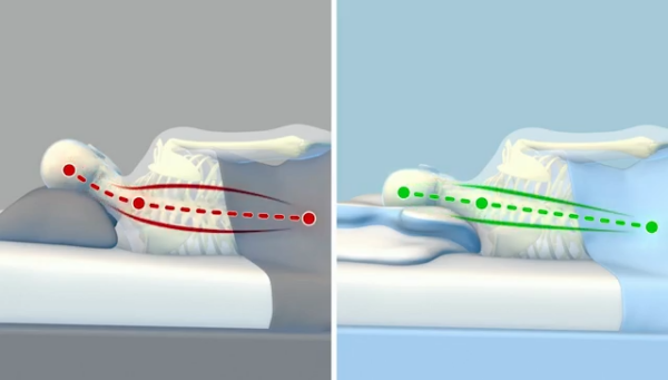 Decompress Your Neck While You Sleep. Your pillow is destroying your neck… but VelaSleep can fix it!