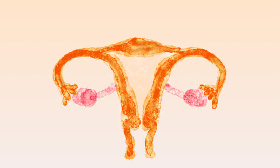 PCOS: One of Women’s Most Misunderstood Conditions