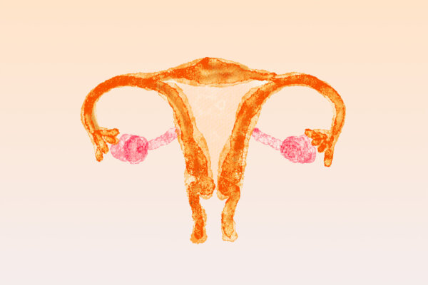 PCOS: One of the Most Misunderstood Conditions Women Face