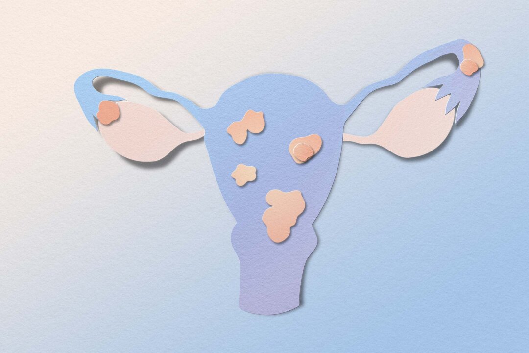 (Illustration by The Epoch Times, Shutterstock)