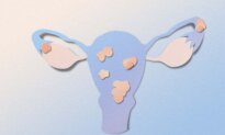 New Noninvasive Imaging Could Cut Years Off Endometriosis Diagnosis