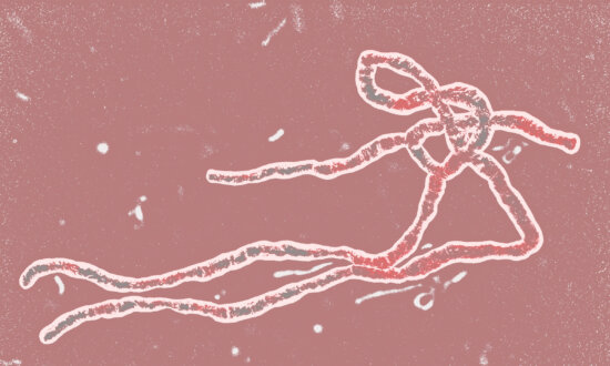 Ebola Virus Is Deadly, but Here’s Why You Don’t Need to Worry