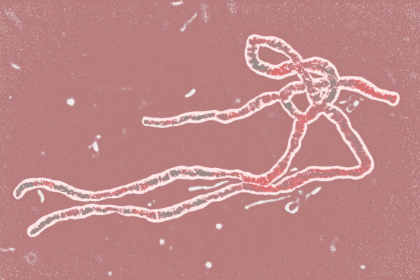 Ebola Outbreak—Why You Don’t Need to Worry in US