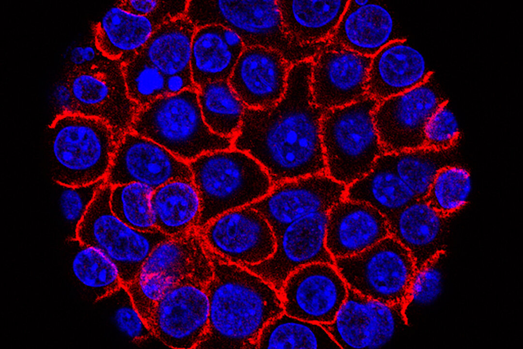 Pancreatic cancer cells, nuclei in blue, growing as a sphere encased in membranes, red. (Min Yu/Eli and Edythe Broad Center for Regenerative Medicine and Stem Cell Research at USC, USC Norris Comprehensive Cancer Center)