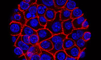 Drug Reduces Risk of Prostate Cancer Spread and Death in Late-Stage Study