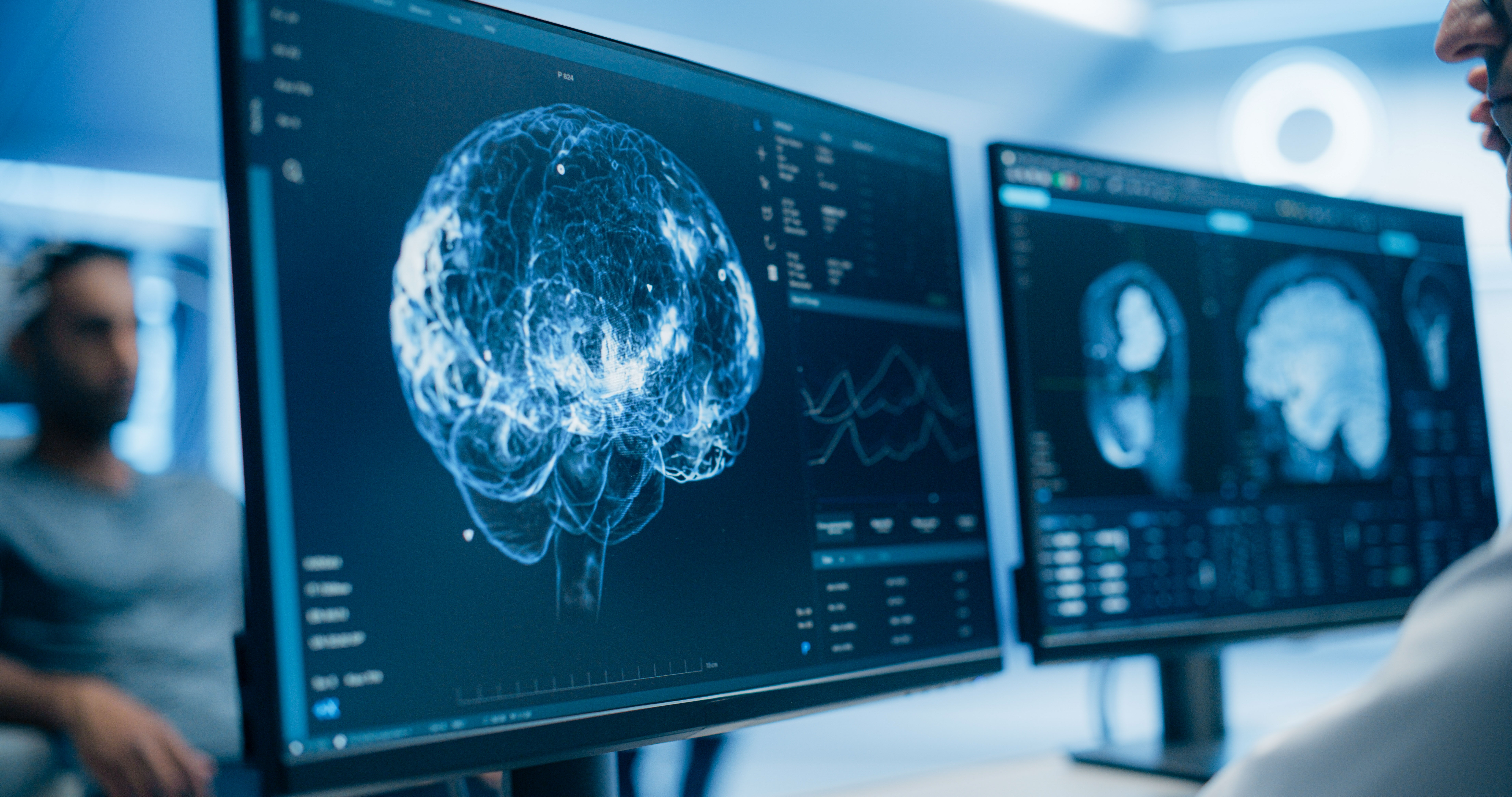 Medical,Brain,Scans,On,Multiple,Computer,Screens.,Advanced,Neuroimaging,Technology