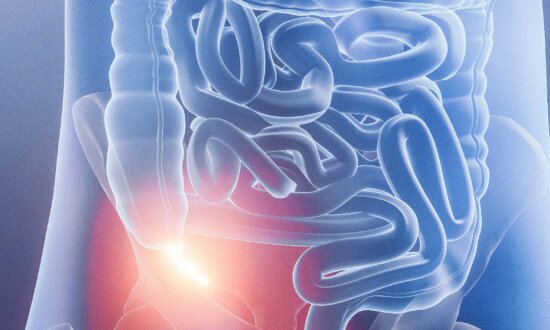 Removing the Appendix Linked to Higher Alzheimer’s Risks
