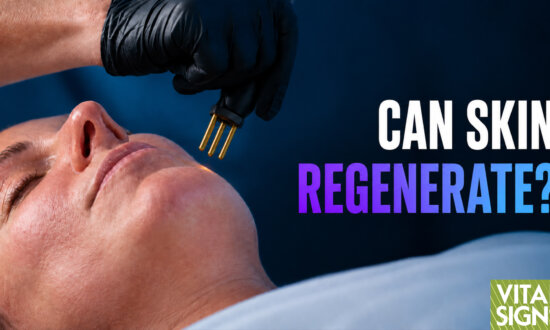 Nitrogen Plasma: Skin Treatment Hope for Acne Scars, Wrinkles, Sagging?