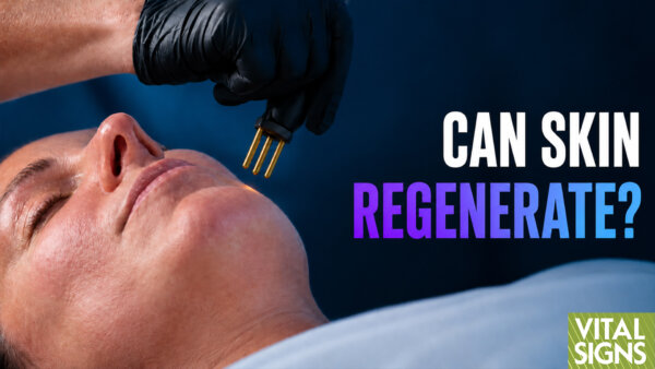 Nitrogen Plasma: Skin Treatment Hope for Acne Scars, Wrinkles, Sagging?