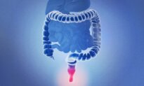 Hemorrhoids–Expert’s Review Offers Best Practice Advice