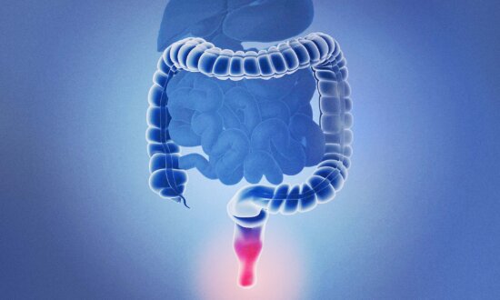 Hemorrhoids–Expert’s Review Offers Best Practice Advice