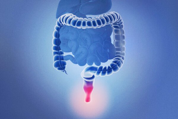 Hemorrhoids–Expert’s Review Offers Best Practice Advice
