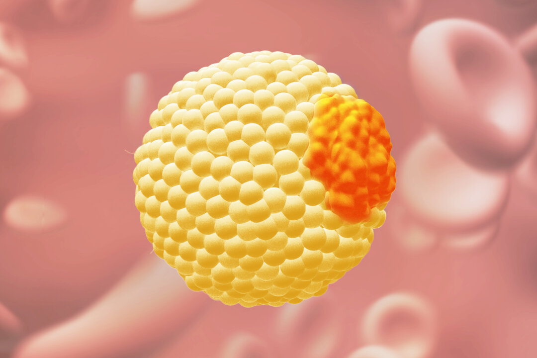 Apolipoprotein B is the orange protein on the right side of the yellow cholesterol carrier. (The Epoch Times/Shutterstock)