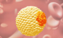 Why ApoB Is Sometimes a Better Test Than Cholesterol