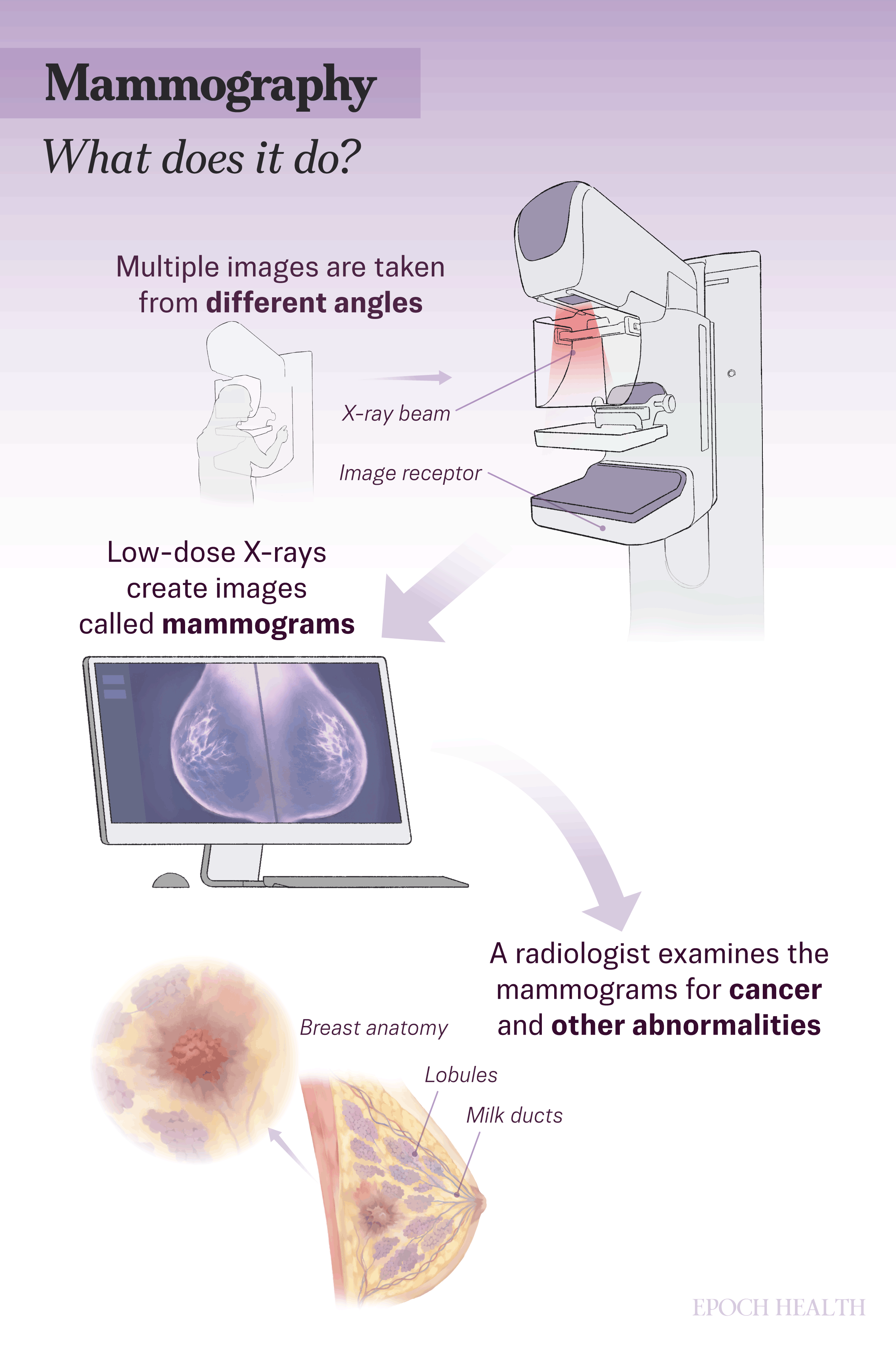 Mammography-gif