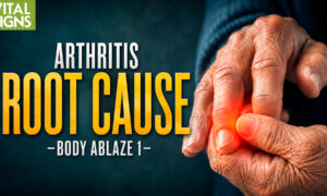 Silent Trigger of MS, Rheumatoid Arthritis – Brain Surgeon Reveals