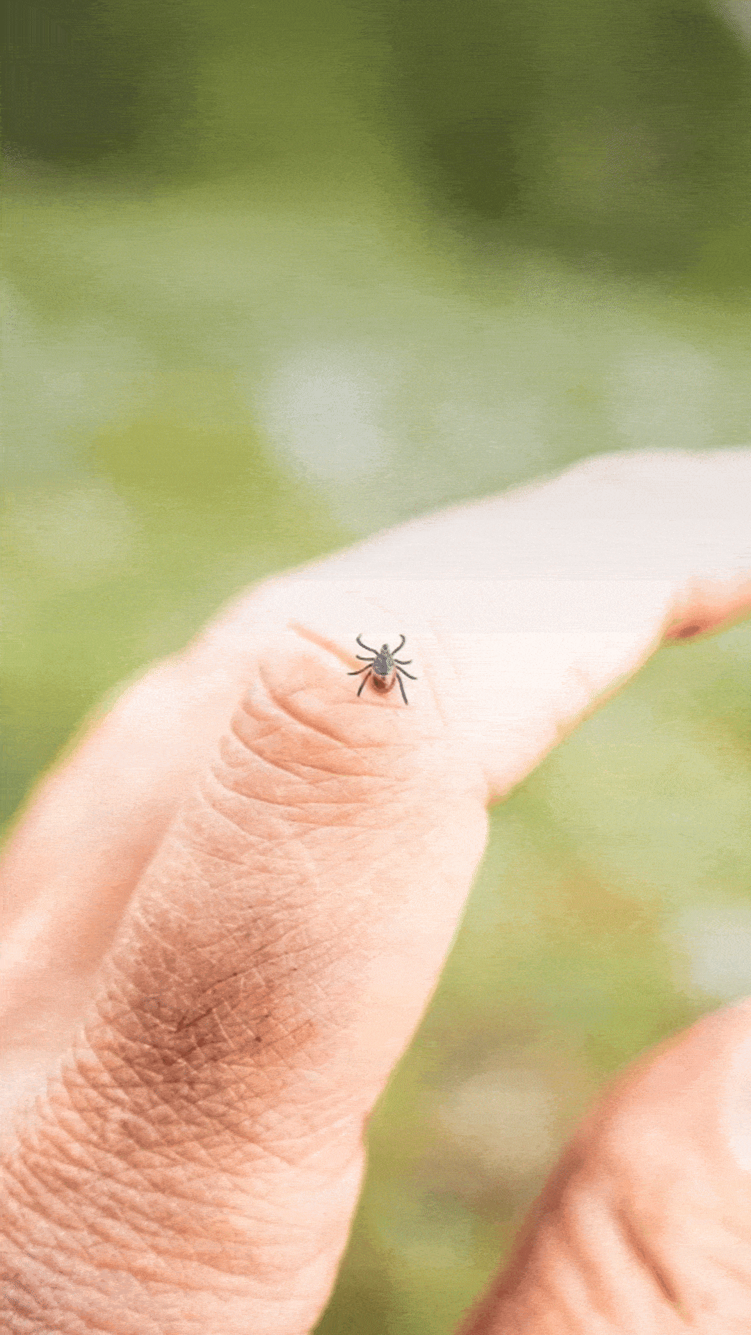 How to Stay Tick-Free This Summer
