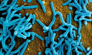Uganda Detects Severe Disease Amid Ebola Outbreak: WHO