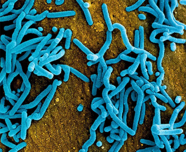 Uganda Detects Deadly Disease Amid Ebola Outbreak