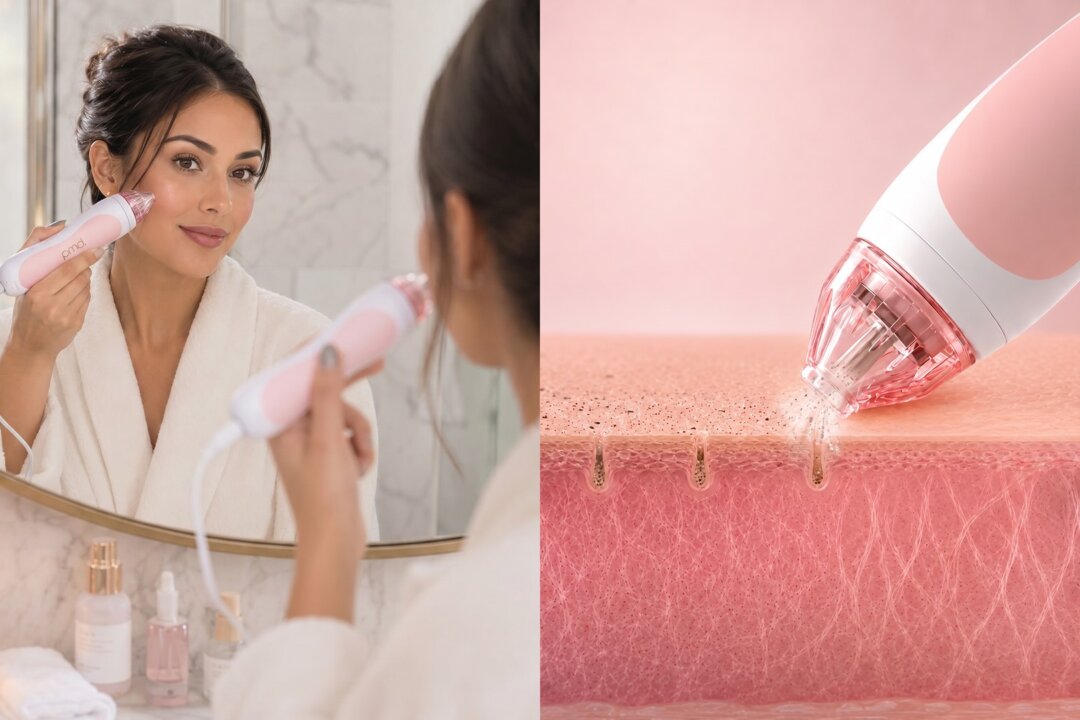 Why Millions of Women Are Ditching Expensive Spa Treatments for This ‘At-Home Microderm’ Device