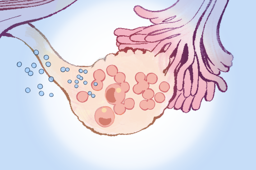 (Illustration by Ran/The Epoch Times)