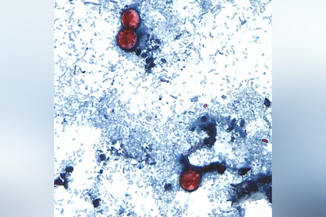This undated photo taken through a microscope provided by the CDC shows Cyclospora cayetanensis oocysts found in a fresh stool sample. (CDC via AP)