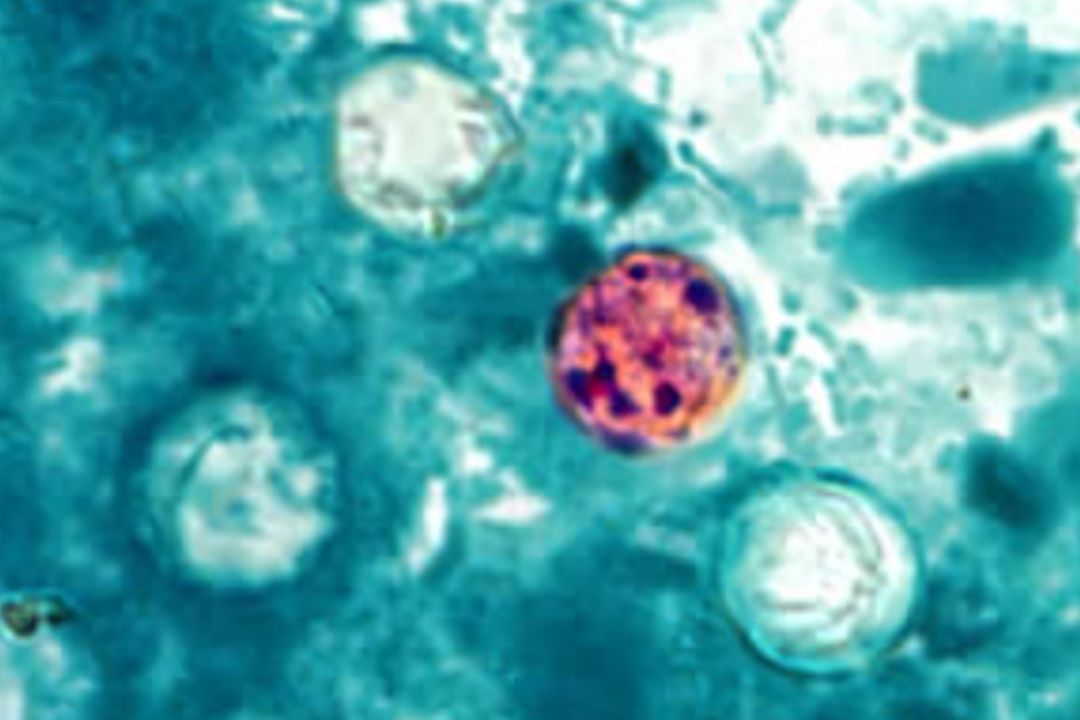 Cyclospora cayetanensis oocysts in a stool sample in a file image. (CDC via The Epoch Times)