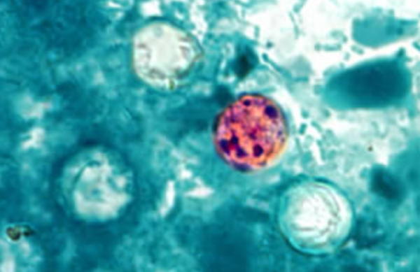  Possible Source Identified for Diarrhea-Causing Parasite