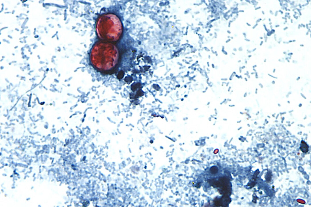 This undated photo taken through a microscope shows Cyclospora cayetanensis oocysts found in a fresh stool sample which had been prepared with a formalin solution and stained with safranin. (CDC via AP)