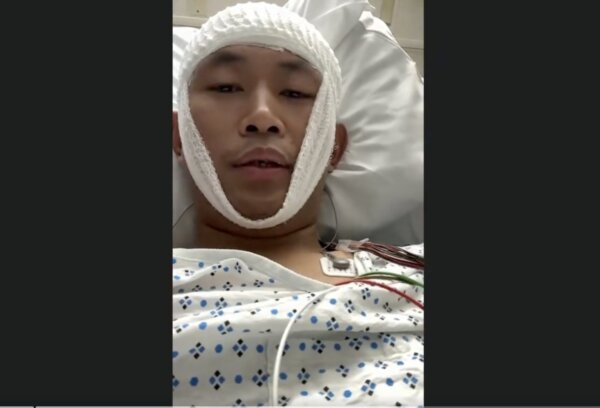 Repeatedly Targeted Anti-CCP Activist Beaten Unconscious in New York