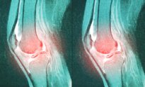 One of the Most Common Knee Surgeries May Be Doing More Harm Than Good